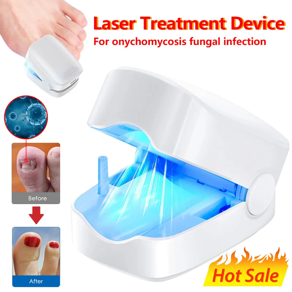 Rendre Vos Ongles Sains et Esthétiques Grâce à une Innovation Laser Révolutionnaire