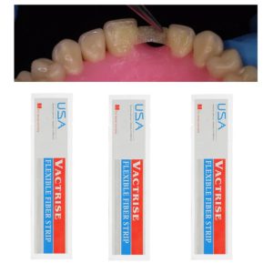 Révolutionnez Votre Pratique Dentaire grâce à Ces Bandes Flexibles en Fibre de Verre