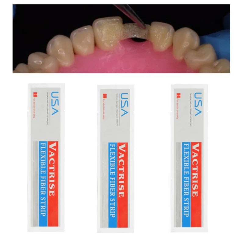 Révolutionnez Votre Pratique Dentaire grâce à Ces Bandes Flexibles en Fibre de Verre
